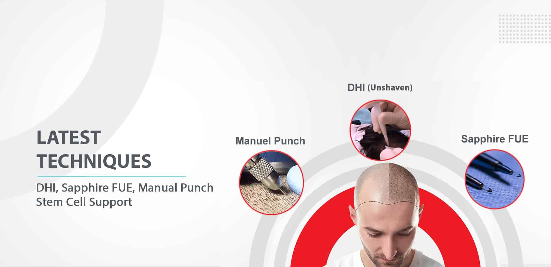 Sapphire FUE Hair Transplant in Turkey