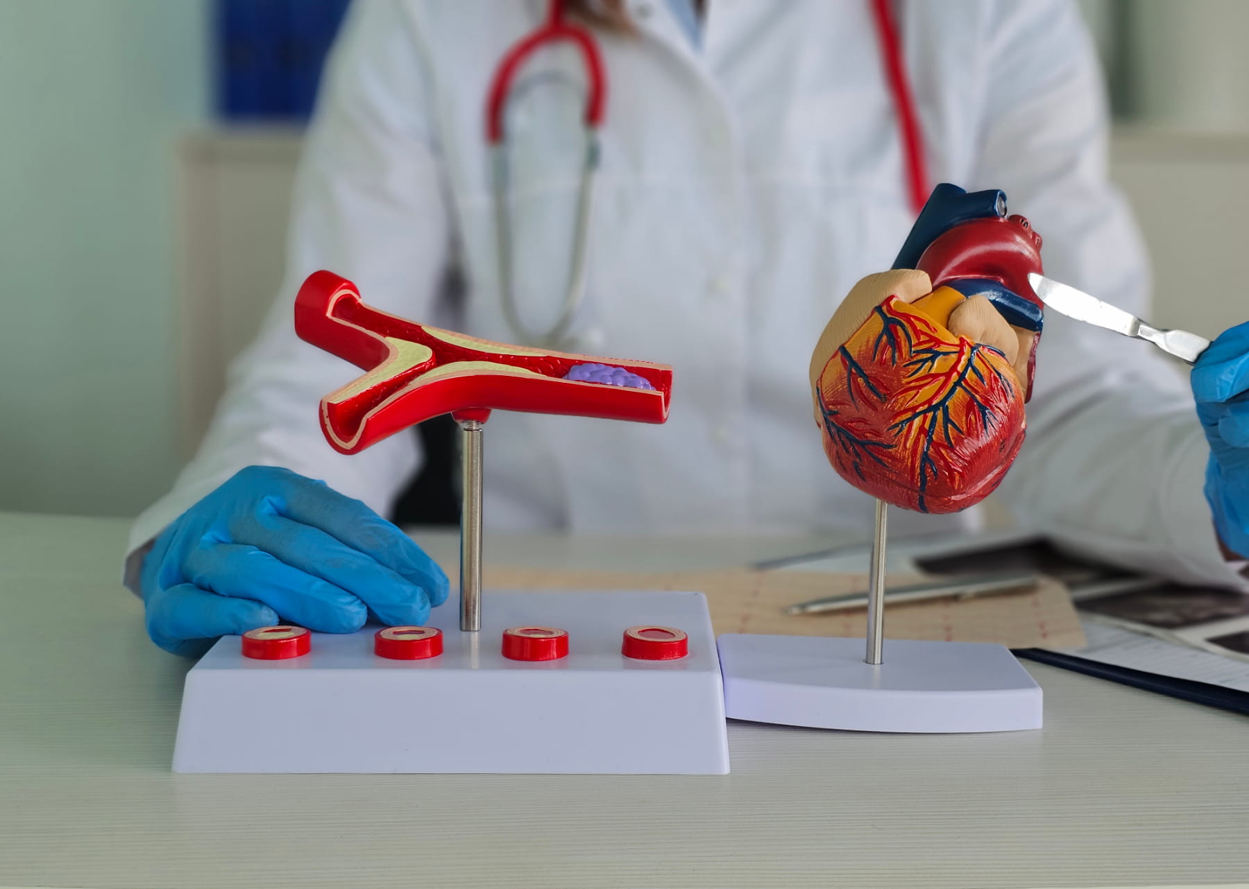Hospital coordination for CABG treatment