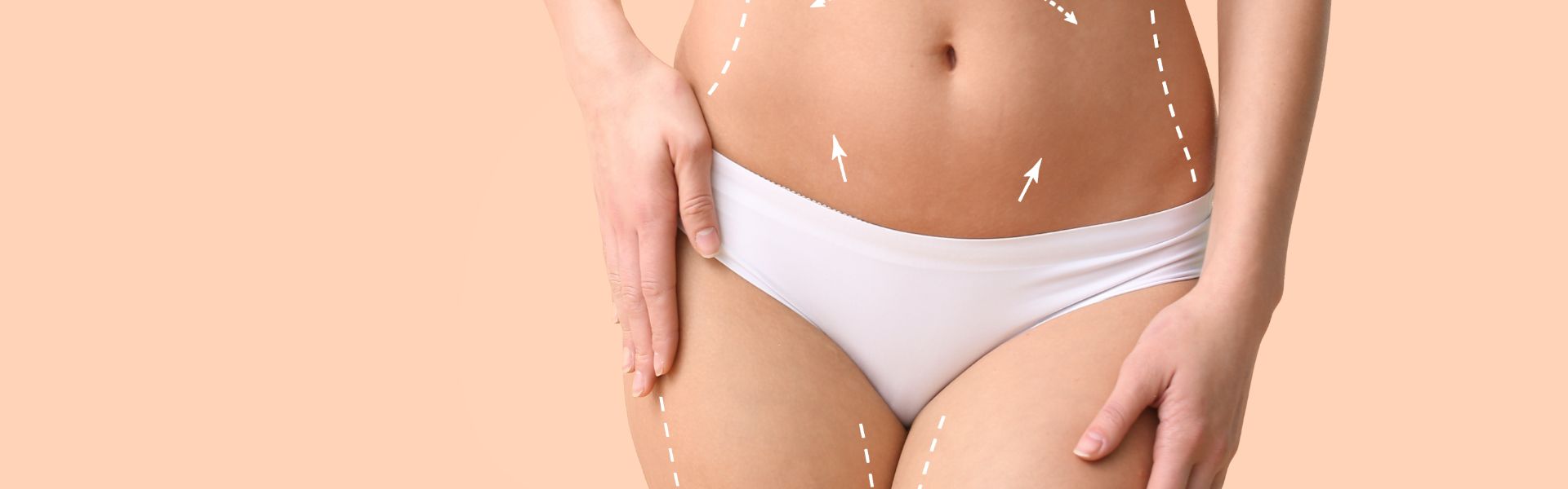 Tummy Tuck Abdominoplasty in Turkey